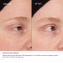 UNRETOUCHED IMAGES*
*Results will vary. As reported by 30 participants in a 12-week consumer perception study after 4 weeks of 2x daily use. 