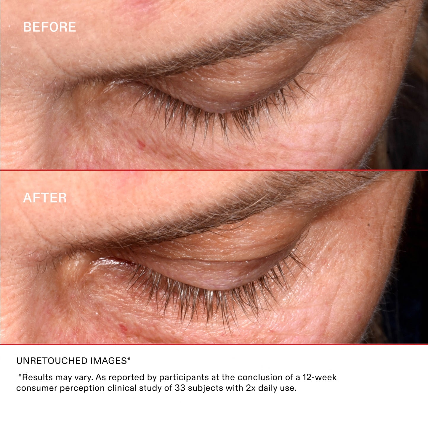  UNRETOUCHED IMAGES*

*Results may vary. As reported by participants at the conclusion of a 12-week consumer perception clinical study of 33 subjects with 2x daily use. 